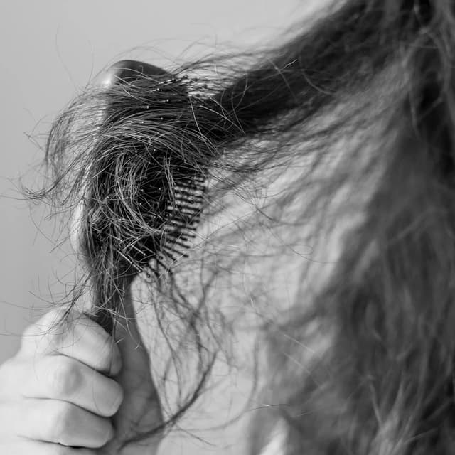 Hair Fall & Hair Thinnig